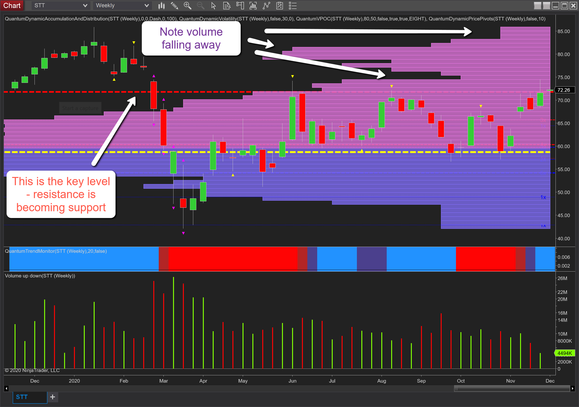 State Street Corporation preparing to develop a bullish trend | Anna